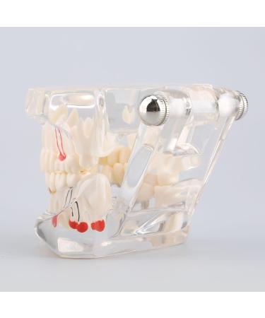 Boxwizard Tooth Model for Dentistry Students | Typodont Dental Diseases Teaching Aid - Adult Demonstration Tooth Model - Buy Online on GoSupps.com