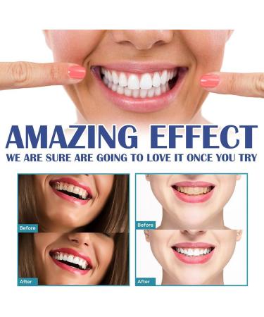 Fivfivgo Gum Instant Treatment Gel & Teeth Whitening Essence - 2PCs | Fast Relief & Whitening Solution - Buy Online on GoSupps.com