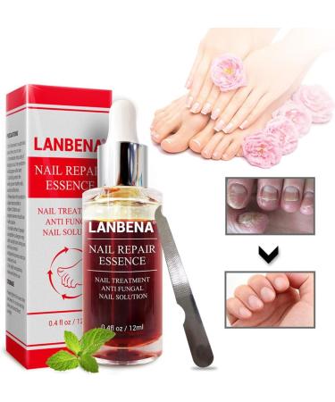 Beito 1PC Nail Repairs Solution de renouvellement des ongles l'huile essentielle tue les ongles fongiques Traitement fongique pour ongles cassants et craquel s (12ML) - Buy Online on GoSupps.com