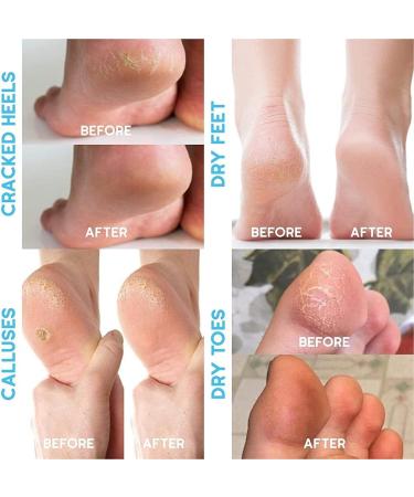 Pumice Stone Callus Remover & Exfoliator for Smooth, Soft Feet - Natural Terracotta Pedicure Tool for Cracked Heel Repair - Buy Online on GoSupps.com