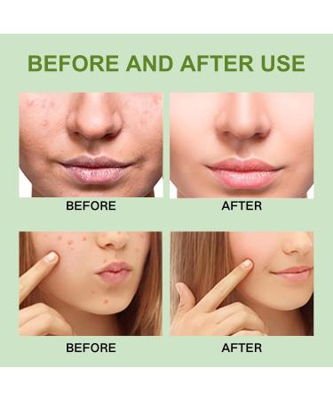 Green Tea Face Mask Kaolin Clay Mask for Pores Skincare Organic Mud Mask for Face Green Tea Deep Cleanse Mask Deep Cleansing Reducing Acne & Oil Smoothing & Anti Aging Reduce Blackhead - Buy Online on GoSupps.com