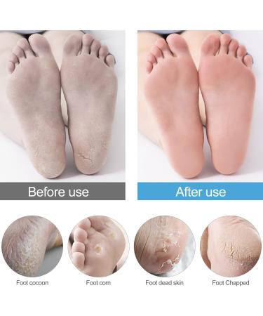 Sularpek Callus Rasp - Stainless Steel Foot File for Effective Callus Removal | Pedicure Tool - Buy Online on GoSupps.com