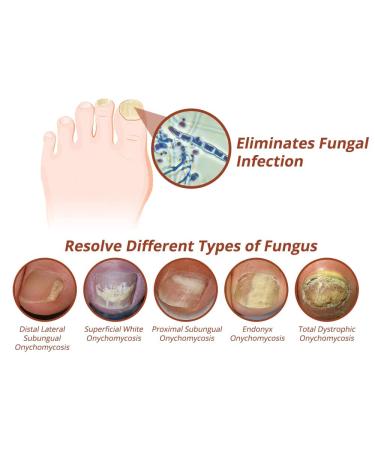 7 Days Nail Growth & Strengthening Serum - Repair Essence Nail Cuticle Oil - Stronger Nails in 1 Week - Nail Strengthening Treatment (1PC) - Buy Online on GoSupps.com