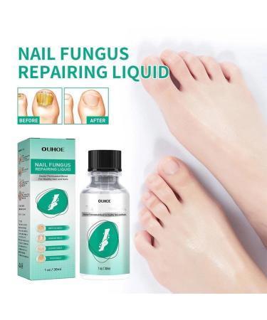 2Pcs Kerassentials Toenail Fungus Treatment - Healthy Skin, Hair & Nails Formula - Buy Online on GoSupps.com