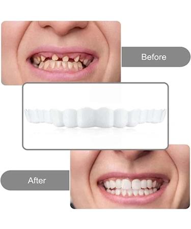 Asiacreate Temporary Dentures Kit - Customizable Smile Teeth Veneers - Buy Online on GoSupps.com