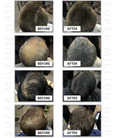 Super Million Hair 1 x 25g Hair Building Fibers No. 6 Light Blonde - Buy Online on GoSupps.com