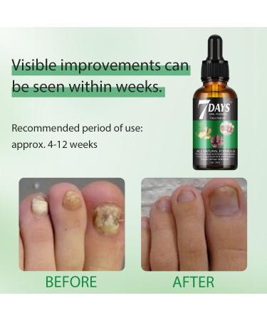 Nail Growth Serum with Ginger Extract - Repair & Strengthen Beautiful Nails | 30ml International Shipping - Buy Online on GoSupps.com