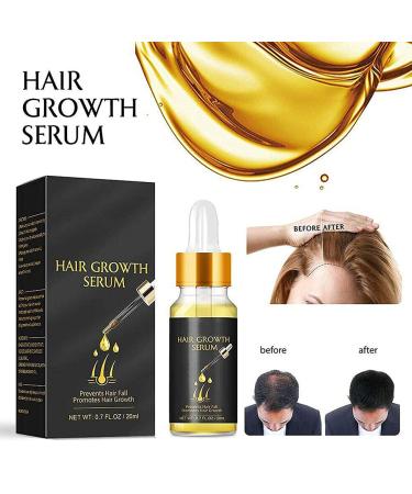 Akemaio Hair Growth Serum - Biotin & Ginger Essence Oil for Fast Hair Growth | Herbal Thickening Oil for Hair Loss - Buy Online on GoSupps.com