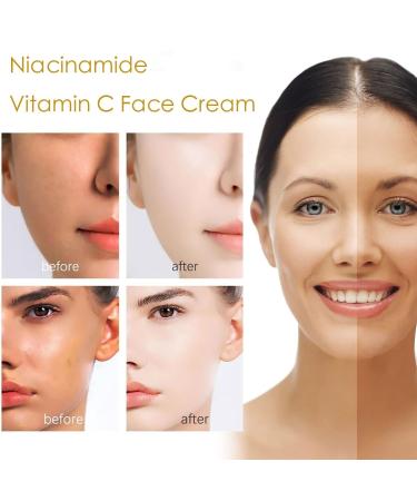 LQDNJOFF Nicotinamide Vitamin C Plain Face Cream Niacinamide Vitamin C Black Tube Skin Cream Multifunctional Smooth Hydrating Niacinamide Makeup Cream(2pcs) - Buy Online on GoSupps.com