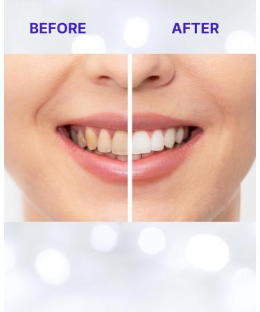 Teeth Whitening Strips - 14-Day Treatment for Sensitive Teeth | Achieve a Whiter Smile & Remove Tough Stains | Made in USA - Buy Online on GoSupps.com