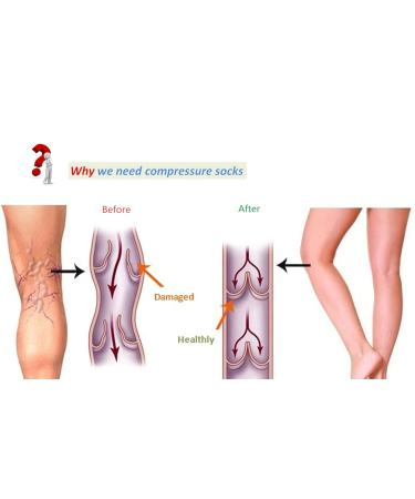 Premium Compression Recovery Calf Sleeves | 20-30mmHg Support for Leg Pain Relief | Sports Running & Shin Splints | Small Black HXT003BS - Buy Online on GoSupps.com