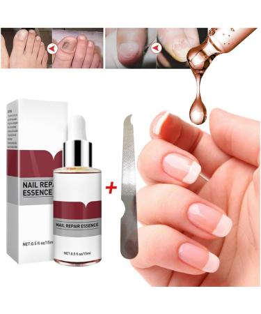 1PC Nail Treatment Nail Renewal Solution Toenails & Fingernails Nail Repairs Essential Oil Protects Toenail Fungus Treatment From Discoloration Brittle And Cracked Nail(12ML) - Buy Online on GoSupps.com