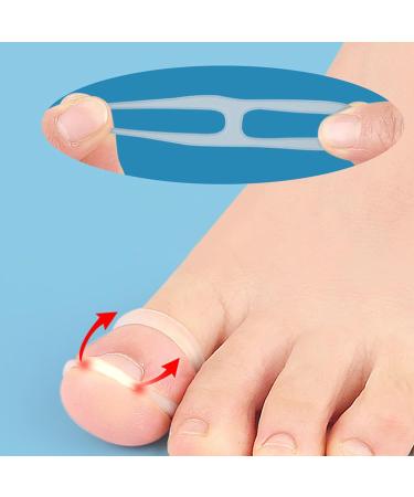 Silicone Ingrown Toe Nail Corrector Quick Relief and Effective Recovery for Ingrown Toenail Care Transparent Silicone Material - Buy Online on GoSupps.com