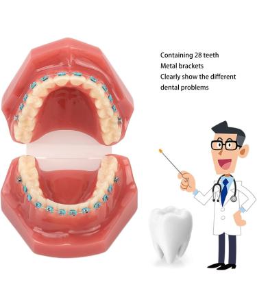 Typodont Orthodontic Tooth Model (28 Teeth) - Realistic Crowded Teeth & Malocclusion Representation for Dental Education & Practice - Buy Online on GoSupps.com