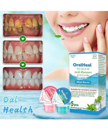 Oralheal Jelly Cup Mouthwash - Restore Teeth & Freshen Breath | 2PCs - Buy Online on GoSupps.com