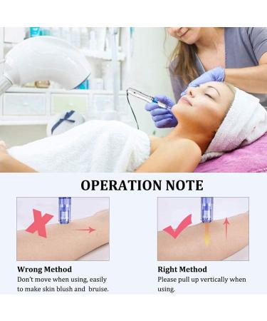 Buy Electrical Microneedling Pen for Skin Care | Dermapen & Dermaron Roller | Treat Wrinkles Acne Scars Stretch Marks Hair Loss | 0.25-2.5mm 12pin 36pin Nano Needles | International Shipping Available - Buy Online on GoSupps.com