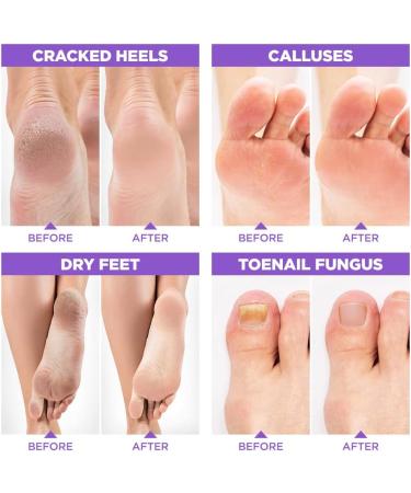 Lavender Oil Foot Soak with Epsom Salt for Dry Cracked Feet - Made in USA - 1 LB Lavender - Softens Calluses, Soothes Sore Feet & Removes Odor - Athlete's Foot Relief - Buy Online on GoSupps.com