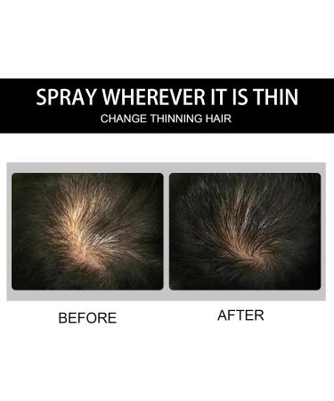 Hair Thickening Fiber Powder - 12g Hair Building Fibers for Men & Women | Instant Hair Loss Concealer & Fuller Look | Natural Black - Buy Online on GoSupps.com