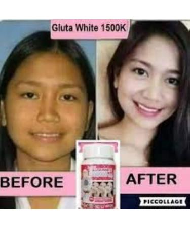 Supreme Gluta White 1500000mg Whitening & Anti Aging Capsules - Reduce Freckles, Fast Action Softgel | 30 Tablets - Buy Online on GoSupps.com