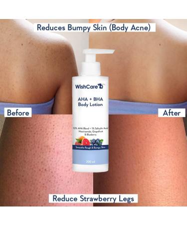 Polet 10% AHA + 1% BHA Body Lotion - Exfoliating Glycolic & Lactic Acid for Smooth Bumpy Skin - 200ml | Best Moisturizer with Niacinamide - Buy Online on GoSupps.com