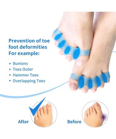 AGARES Toe Spacers (8-Piece Set) | Bunions Correction for Women & Men | Toe Brace for Foot Pain & Plantar Fasciitis - White - Buy Online on GoSupps.com