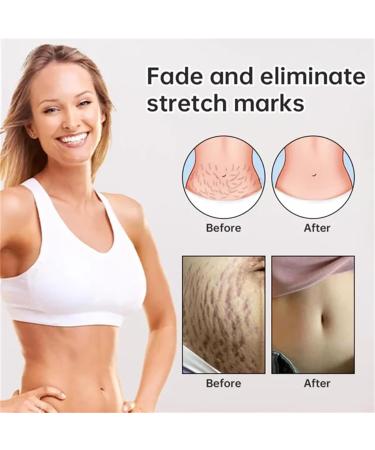 Goopgen Advanced Scar Repair Serum - Scar Removal Ampoule Spray (1pcs) - For All Types of Scars - Buy Online on GoSupps.com