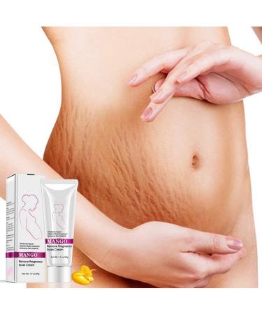 Best Stretch Mark Cream for Pregnancy & Postpartum - Repair & Remove Scars - Buy Online on GoSupps.com