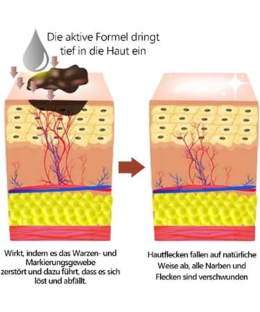 Bee Venom Ointment & Cream - 30ml Moisturizing Treatment for All Skin Types | Natural Anti-Aging Formula for Men & Women - Buy Online on GoSupps.com