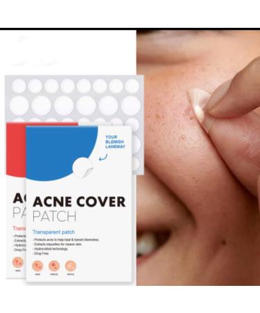 Buy Invisible Acne Patches - 144 Hydrocolloid Stickers for Face & Body | Effective Acne Treatment - International Shipping - Buy Online on GoSupps.com