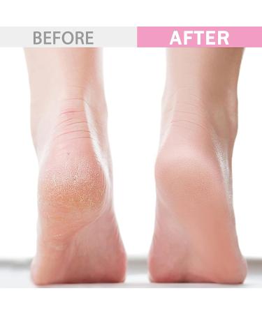 HDKAJL 2 Pairs Silicone Moisturising Socks Silicone Feet Moisturiser Meia de Silicone Silicone Socks for Women Suitable for Foot Peel Mask Athletes Foot Treatment Preventing Nutrient Loss - Buy Online on GoSupps.com