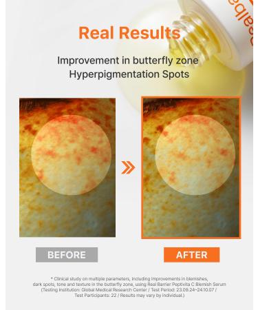 Real Barrier | Peptivita C Blemish Serum | Face Serum for Uneven Skin Tone & Smooth Texture | Vitamin C Face Care for Sensitive Skin | Facial Skin Care Products | Korean Skincare | 1.01 fl oz (30ml) - Buy Online on GoSupps.com