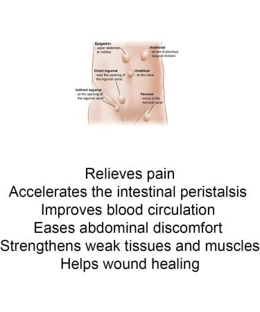 HerniaGONE for Adult - Essential Oil Blend Easy to Apply topically Tested for 50+ Years Natural Extraction for Adult Hernias Try it for 1-2 Weeks - Buy Online on GoSupps.com