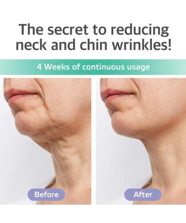 Neck Firming & Double Chin Reducer Cream 8 oz Tightens Skin & Reduces Double Chin Improves Elasticity and Firmness for a Defined Jawline - Buy Online on GoSupps.com