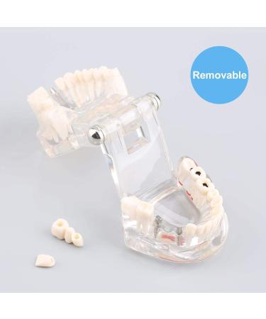 Teeth Model for Dental Teaching & Research | Realistic Adult Teeth Demonstration | No Brand - Buy Online on GoSupps.com