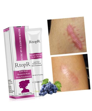 Scar Cream for Face & Body - Skin Repair Gel for Scars - Plastic Care Cosmetics - Assorted Color - 13.1x3cm - Buy Online on GoSupps.com