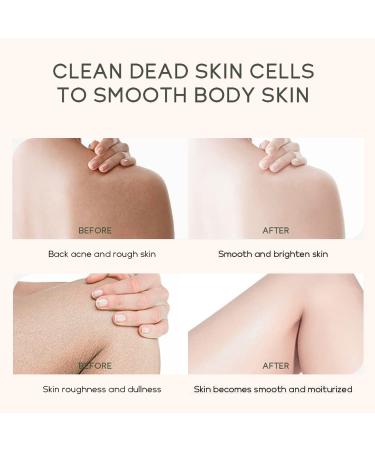 Nicotinamide Body Scrub for Blemishes & Large Pores | Hydrating Skin Renewal - 8.8 Oz - Buy Online on GoSupps.com