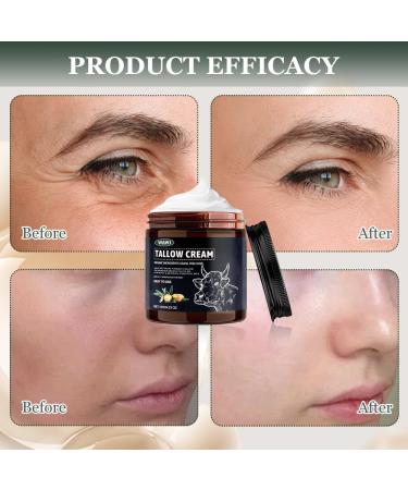 WAWJ Beef Tallow Skincare Organic Beef Tallow Cream Tallow Balm Pure Grass-Based Beef Tallow Cream Organic Beef Tallow for Face and Body Moisturizing Smooth Skin - Buy Online on GoSupps.com