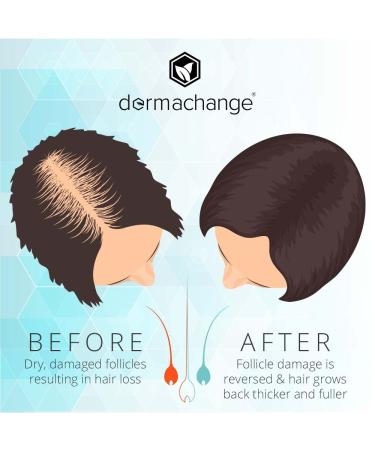 Organic Hair Growth Conditioner for Women and Men - Sulfate-Free - Prevent Hair Loss & Dermatitis - Vitamins Infused - Made in USA - 16oz - Buy Online on GoSupps.com