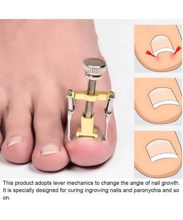 Ingrown Toenail Treatment Ingrown Toenail Corrector Ingrown Toenail Correction Patch Fixer Pedicure Toenail Correction Patch Sticker Foot Care Tool Ingrown Toenail Corrector Strips Foot Care Kit - Buy Online on GoSupps.com