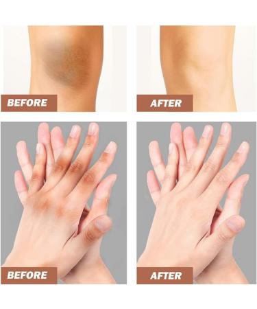 Strong whitening cream for dark knees and elbows The most popular whitening cream in 2023 Dark spot correcting cream Whitening cream for the intimate area Moisturizing the skin - Buy Online on GoSupps.com