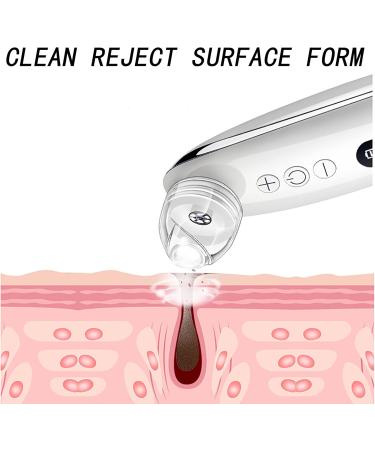 Visualization Facial Pore Cleaner Multifunction Blackhead Removal Device with 4 Suction Tip 20x Magnification Lens Smart Wireless WiFi Connection for Remove Acne Whiteheads Strawberry Nose - Buy Online on GoSupps.com