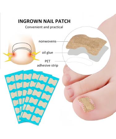 Toenail Patch Ingrown Toenail Toenail Correction Toenail Correction Patch Toenail Correction Patch Ingrown Toenail Nail Care 50 Pieces - Buy Online on GoSupps.com