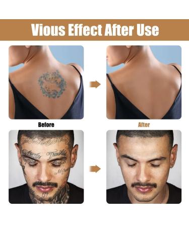 Dark Spot & Scar Tattoo Cover Up Concealer Set | Long Lasting Waterproof Formula - Buy Online on GoSupps.com