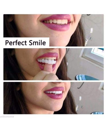 Buy 2 Pairs of Cosmetic Dentures - Veneer Prostheses | Fake Teeth for Men & Women - Perfect Smile Solution - Buy Online on GoSupps.com