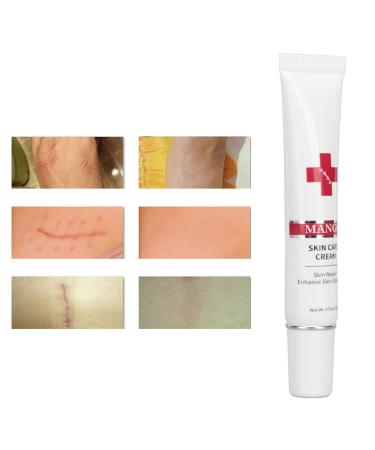Nourishing Plant Based Scar Cream for Safe & Gentle Scar Repair - Buy Online on GoSupps.com