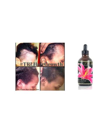 TRL Faster Hair Growth Solution - Black Castor Oil Coconut Oil olive Oil Neem Amla Fenugreek Tea Tree Rosemary (1Pack)