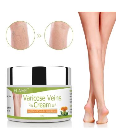 Varicose Veins Cream - Treatment for Phlebitis, Angiitis, Vasculitis, Spider Veins - Improve Blood Circulation for Tired, Heavy Legs - Fast Relief - Buy Online on GoSupps.com