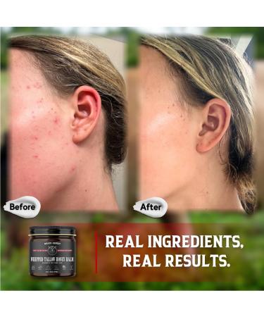 Wrath & Remedy Handmade Organic Beef Tallow Balm for Sensitive Skin | Eczema & Rosacea Relief - Natural Ingredients 4 OZ Eucalyptus - Buy Online on GoSupps.com