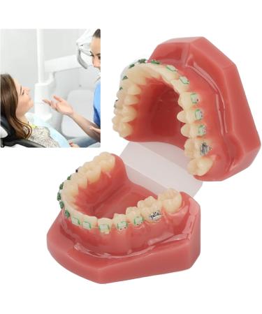 Orthodontic Demonstration Model & Bracket Model - Visualize Orthodontic Process | Worldwide Shipping - Buy Online on GoSupps.com