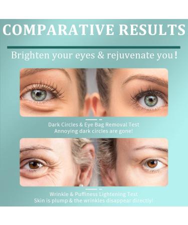 BELLA VITA Green Tea Under Eye Patches - Anti-Aging Collagen Eye Masks for Dark Circles & Puffiness | 30 Pairs - Buy Online on GoSupps.com